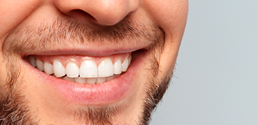 Sonrisa ortodoncia
